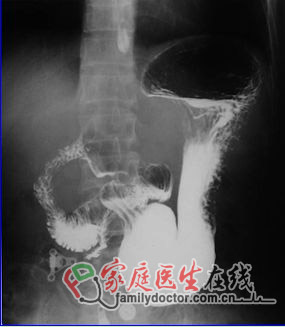 CT檢查、X線檢查等常用醫(yī)學(xué)影像學(xué)檢查方法的價值和局限