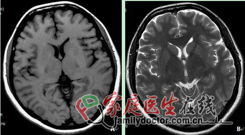 CT檢查、X線檢查等常用醫(yī)學(xué)影像學(xué)檢查方法的價值和局限