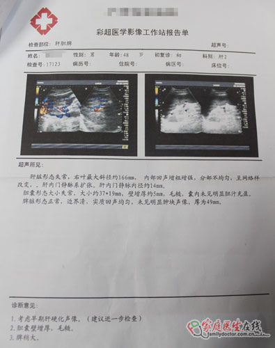 看肝病去正規(guī)醫(yī)院 2例被騙肝病患者真實案例