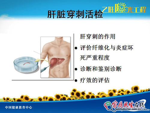 肝炎檢查大全 教你看懂肝病所有檢查項(xiàng)目
