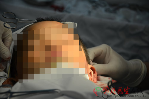 手術(shù)過程