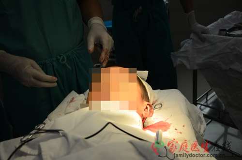 手術(shù)過程